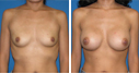 Before & After Photos